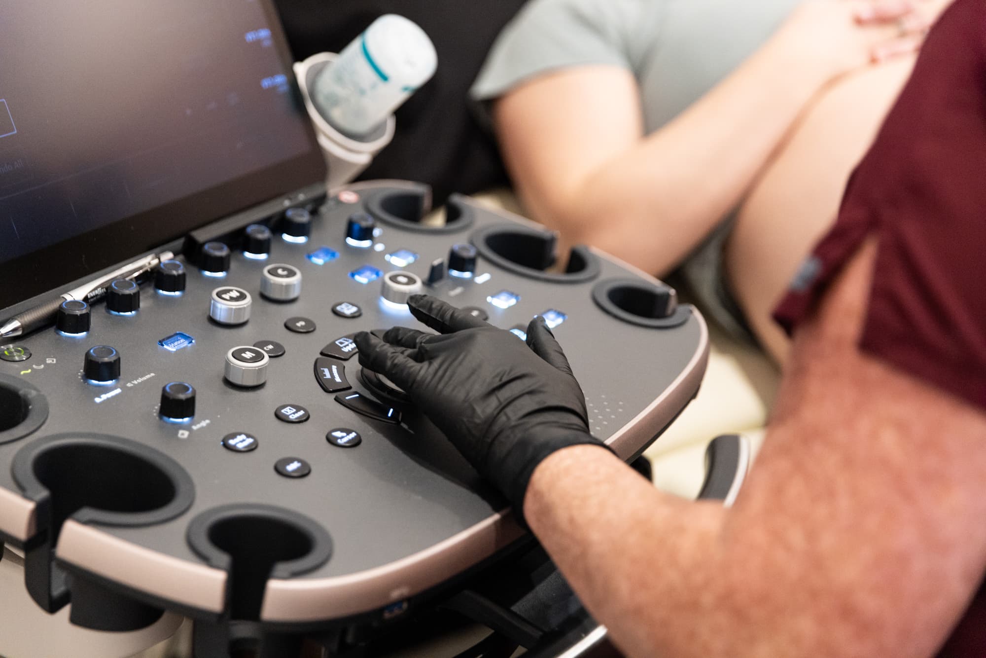 ultrasound machine